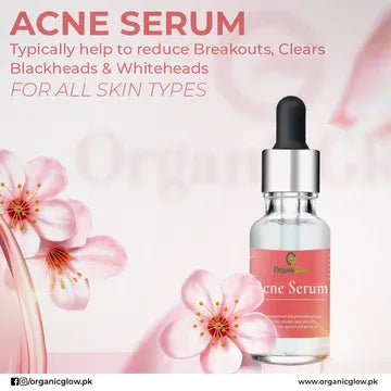 Acne Serum 20ML