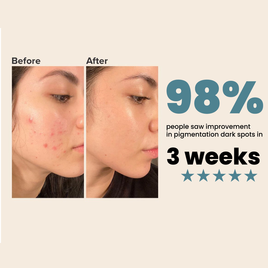 Vitamin C Serum